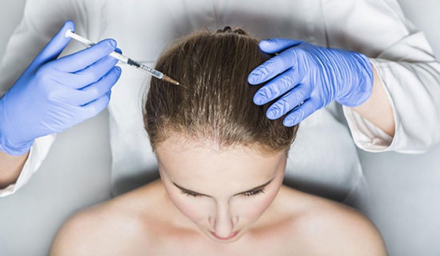 How PRP Hair Treatment in Dubai Can Help You Achieve Natural Hair Restoration