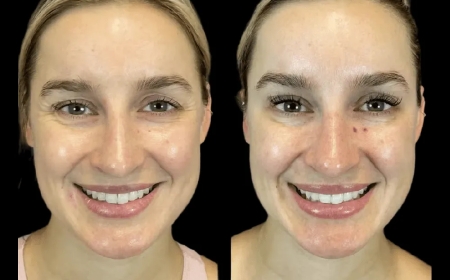 How the Best Aesthetic Clinic in Dubai Boosts Confidence Inside and Out