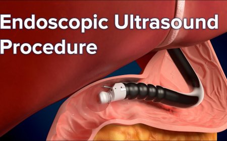 Endoscopic Examination Services: Early Detection for Better Health Outcomes
