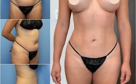 How Body Contouring in Dubai Can Help You Achieve the Hourglass Shape