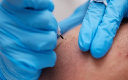 ماذا تتوقع من تصبغ فروة الرأس الدقيق؟