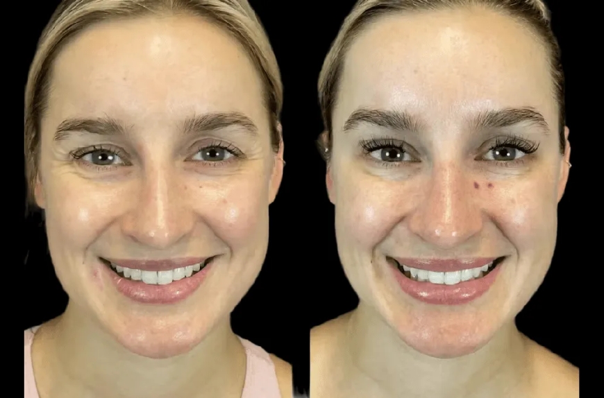 How the Best Aesthetic Clinic in Dubai Boosts Confidence Inside and Out