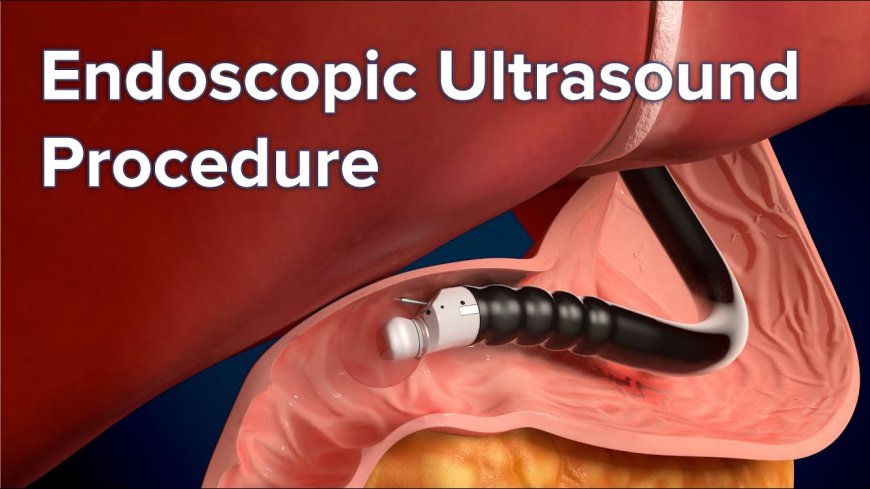 Endoscopic Examination Services: Early Detection for Better Health Outcomes
