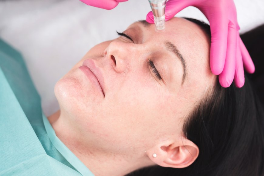 Unveiling Your Best Skin A Guide to Choosing a Top Skin Clinic in Richmond